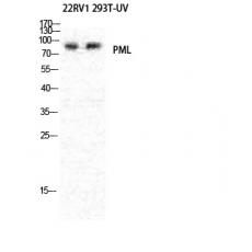 Anti-PML antibody