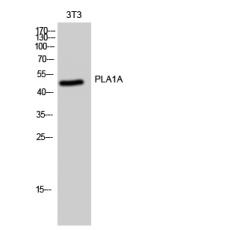Anti-PLA1A antibody