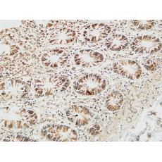 Anti-Reg IV antibody