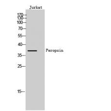 Anti-Peropsin antibody