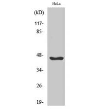 Anti-Serpin B12 antibody