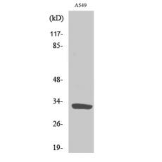 Anti-ZIP9 antibody