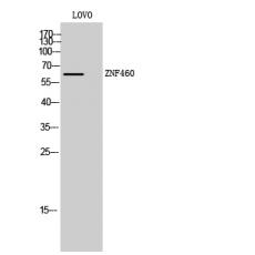 Anti-ZNF460 antibody