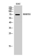 Anti-RHOBTB3 antibody