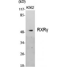 Anti-RXRγ antibody