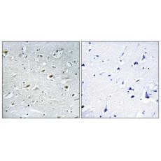 Anti-TACC1 antibody