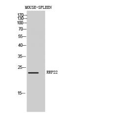 Anti-RRP22 antibody