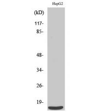Anti-SAP 14 antibody