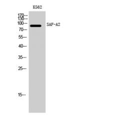 Anti-SAF-A2 antibody