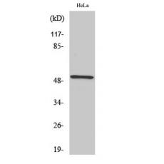 Anti-RSAD1 antibody