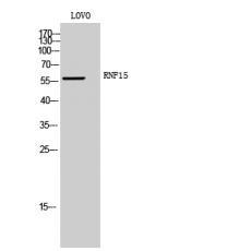 Anti-RNF15 antibody