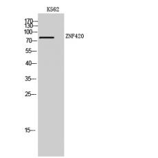 Anti-ZNF420 antibody