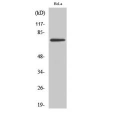 Anti-TBX2 antibody