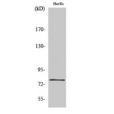 Anti-SnoN antibody