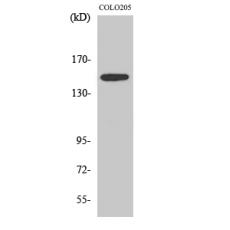 Anti-SLK antibody