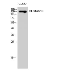 Anti-SLC4A8/10 antibody