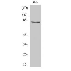 Anti-Snk antibody