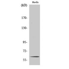 Anti-TCF-4/12 antibody