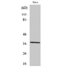 Anti-ZIS antibody