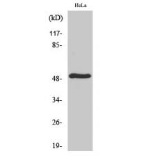 Anti-TDE2L antibody