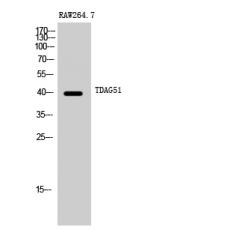 Anti-TDAG51 antibody