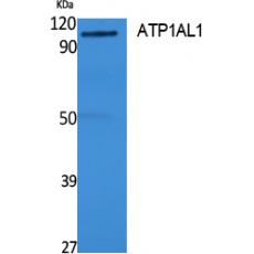 Anti-ATP1AL1 antibody