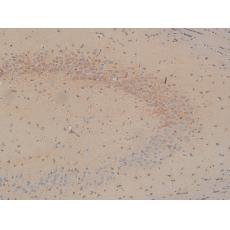 Anti-NF-L antibody