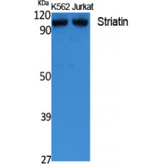 Anti-Striatin antibody