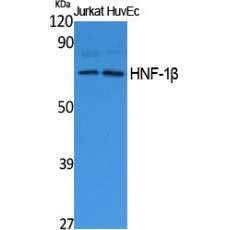 Anti-HNF-1β antibody