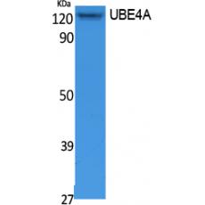 Anti-UBE4A antibody