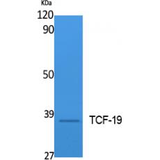 Anti-TCF-19 antibody