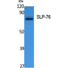 Anti-SLP-76 antibody
