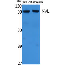 Anti-NVL antibody