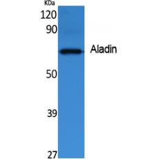 Anti-Aladin antibody