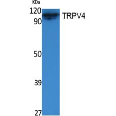 Anti-TRPV4 antibody