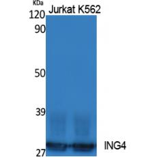 Anti-ING4 antibody