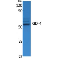 Anti-GDI-1 antibody