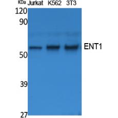 Anti-ENT1 antibody