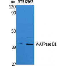 Anti-V-ATPase D1 antibody