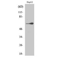 Anti-TESK2 antibody