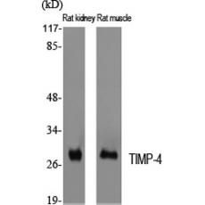 Anti-TIMP-4 antibody
