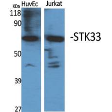 Anti-STK33 antibody