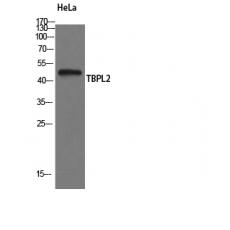 Anti-TBPL2 antibody