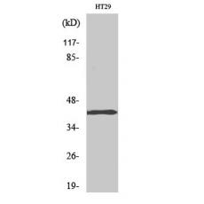 Anti-TBX10 antibody