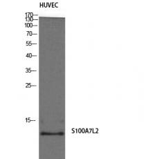 Anti-S-100A7L2 antibody