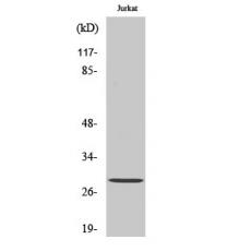 Anti-SCAND1 antibody