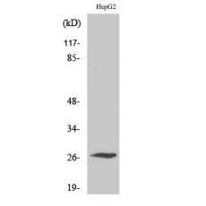 Anti-Scn4b antibody