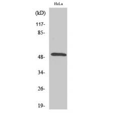 Anti-Secretin Receptor antibody