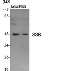 Anti-SSB antibody