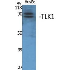 Anti-TLK1 antibody